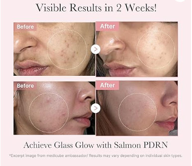 Medicube Salmon DNA PDRN - Kit de prueba