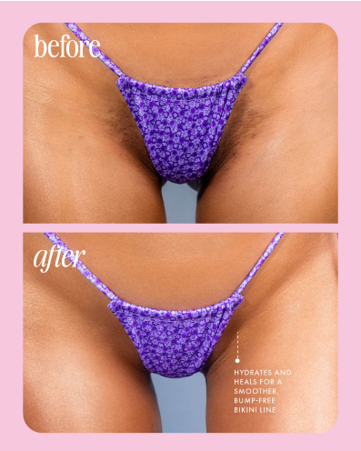 COOKA - Suero Vikini